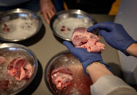 Forskerne fortæller: Pludselig hjertedød