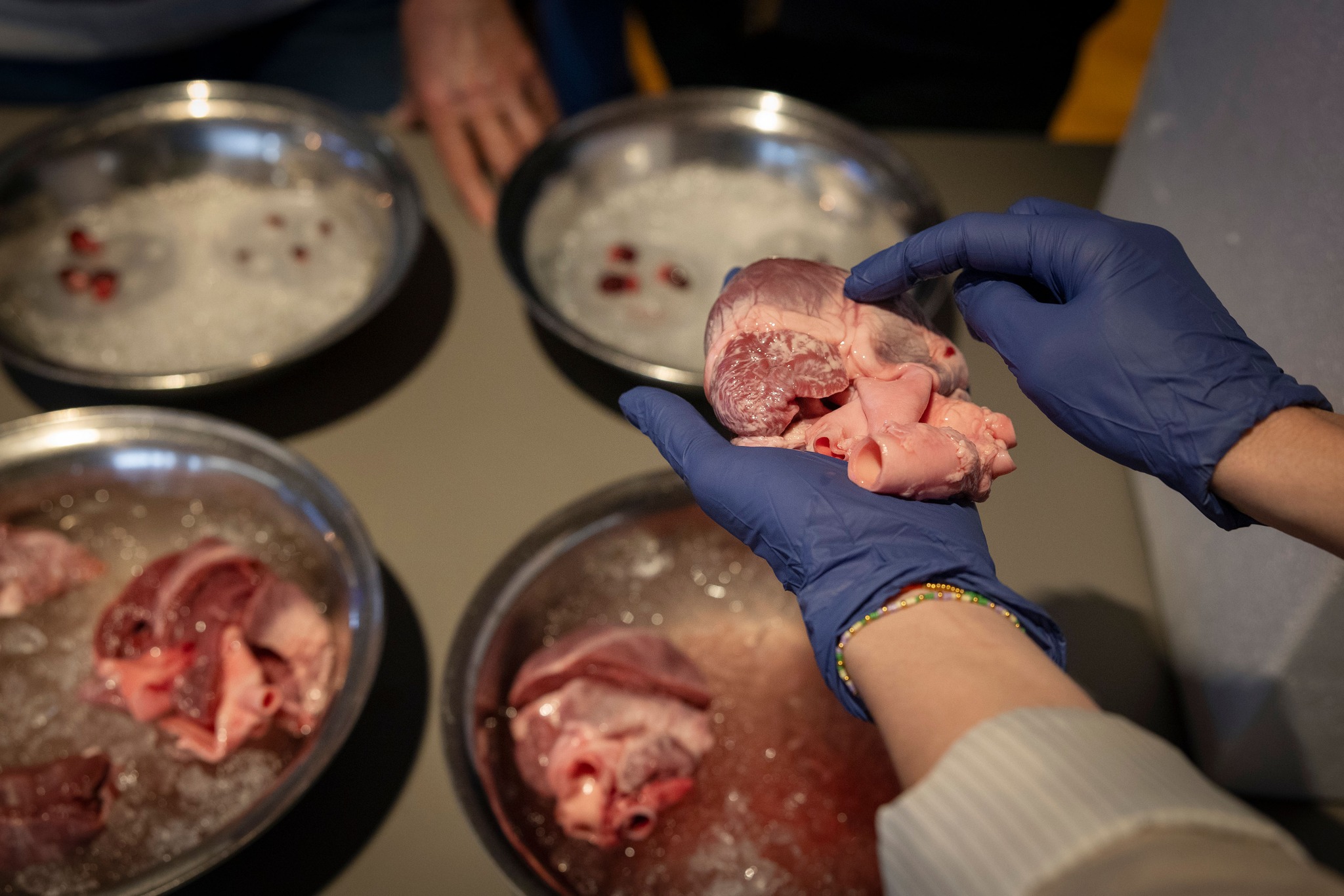 Forskerne fortæller: Pludselig hjertedød