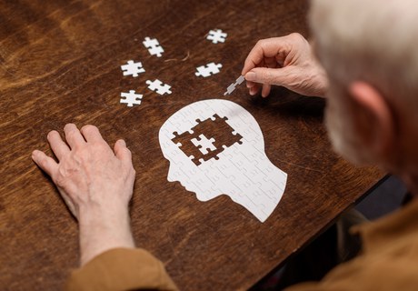 En lægmands guide til Alzheimers: Hvad foregår der egentlig i en Alzheimers-ramt hjerne?