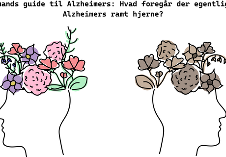 En lægmands guide til Alzheimers: Hvad foregår der egentlig i en Alzheimers ramt hjerne?