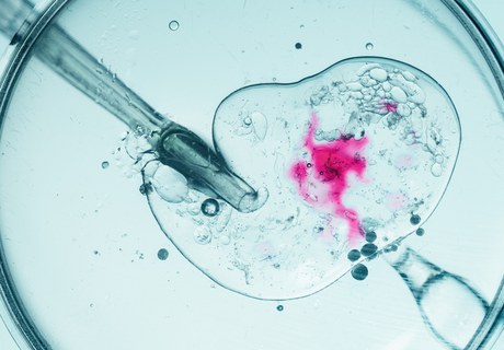 Fertilitetsbehandling - Før, nu og i fremtiden