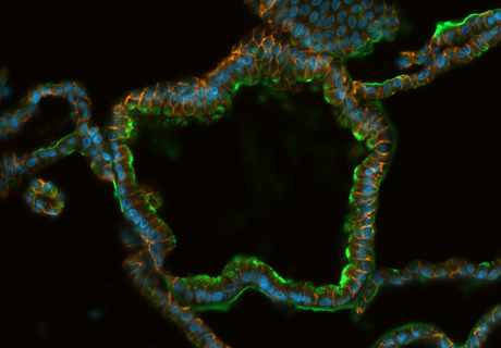 Mini-Organs Reveal the Hidden Sugar Code of the Gut