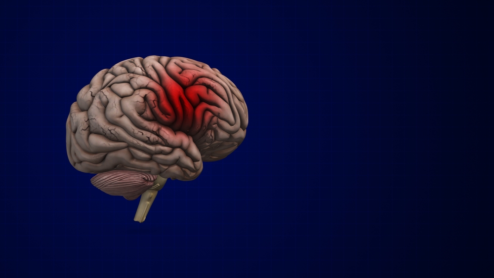 Svær akut hjerneskade - Hvad er det? Hvordan behandles det?