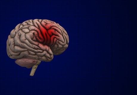 Svær akut hjerneskade - Hvad er det? Hvordan behandles det?