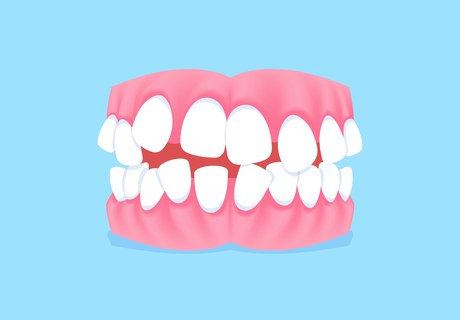 Tændernes rolle for folkesundhed, fællesskaber og kærlighed