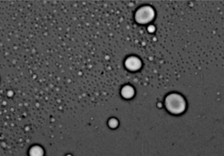 Tiny droplets, big problems: Where disease may begin inside our cells