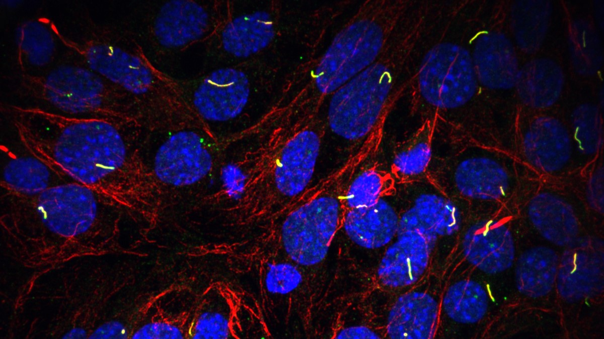 When cells speak, we listen: The antenna of cells and targeted therapies