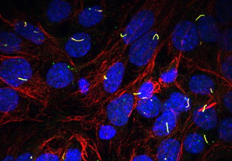 When cells speak, we listen: The antenna of cells and targeted therapies